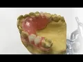 How To Make A Fiber Flex Partial - The Entire Process Dental Lab Learning