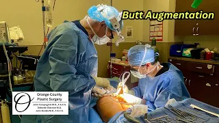 Butt Augmentation Orange County Plastic Surgery Plasticsurgeon Plasticsurgeryresults 