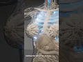 Why COPD Patients Lean Forward to Breathe Tripod Position RN Explains 123