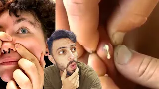 أكبر الحبوب في العالم 