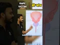 Download Lagu Rape Victim की जांच कैसे करते हैं ? #shorts MP3