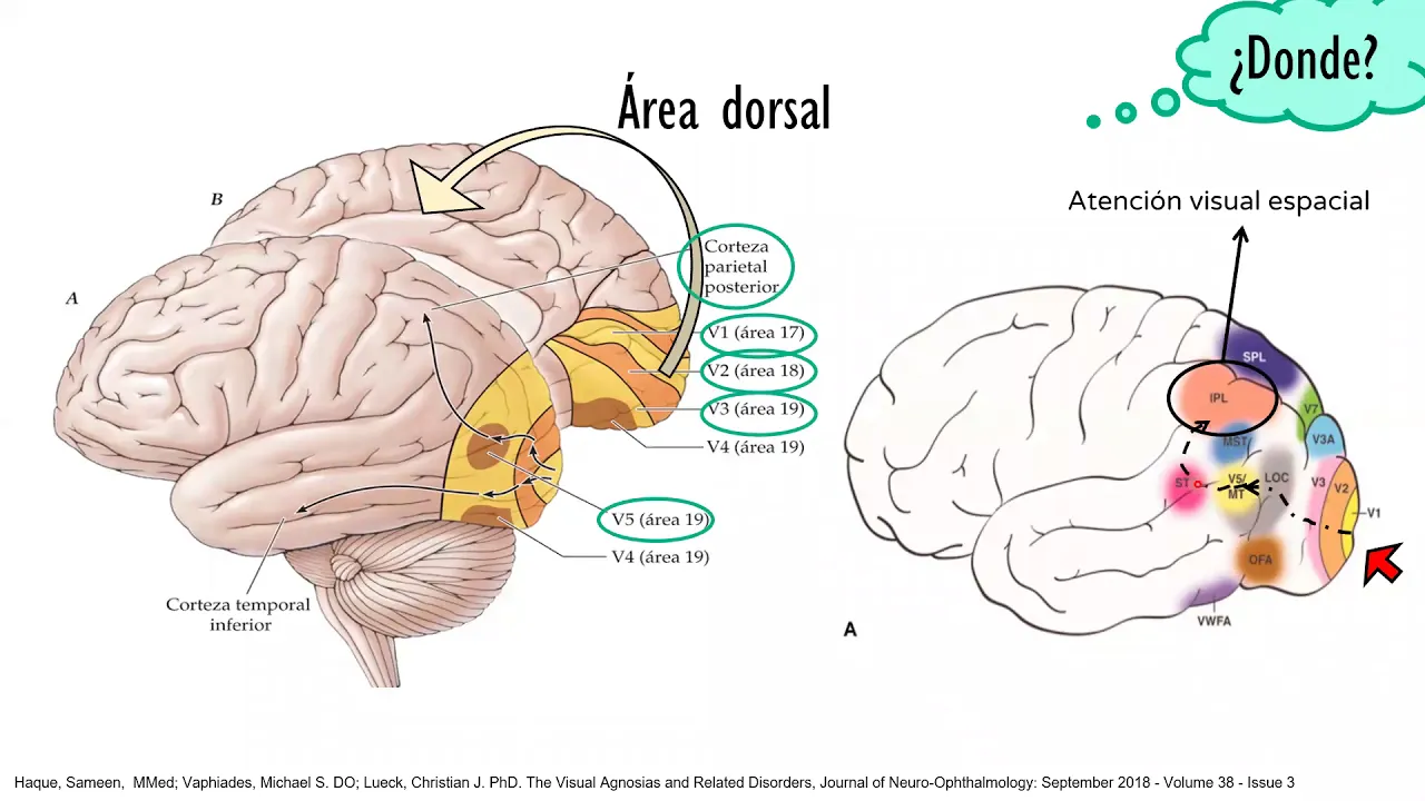 Agnosias visuales