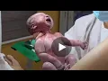Download Lagu Normal spontaneous delivery Birth vlog # 1