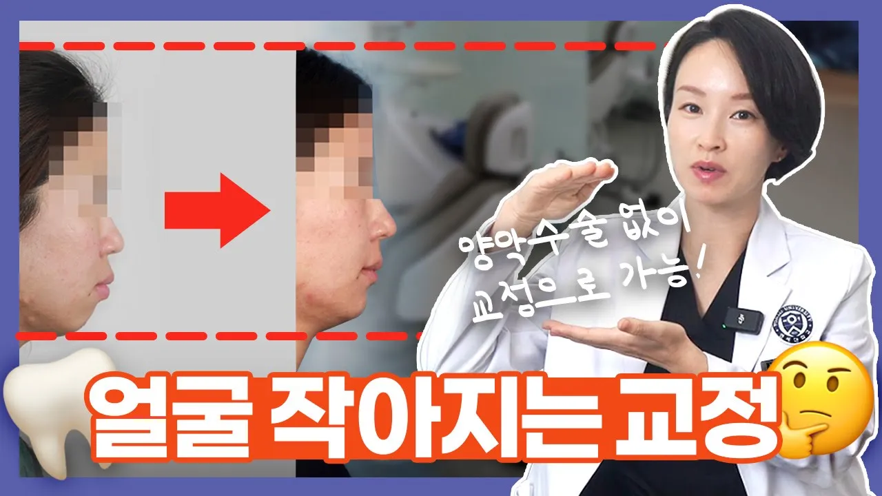 ()치아교정하면 얼굴이 작아진다고? 얼굴 작아지는 교정에 대해 교정학박사가 알려드려요.