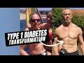 I Cured My Type 1 Diabetes