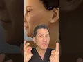 MicroLift VS ThreadLift What Is The Difference