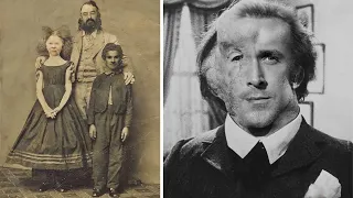 15 Shocking Sideshow Freaks That Actually Exist