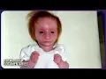 The Tiniest Girl in the World - Charlotte s Inspiring Primordial Dwarfism Journey