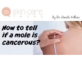 Cancerours moles how to tell if a mole is cancerours