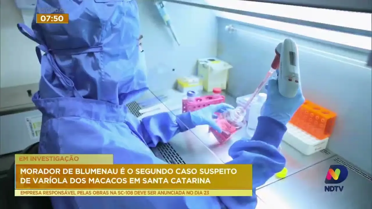 Morador de Blumenau é segundo caso suspeito de varíola dos macacos em SC