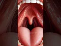 Download Lagu What is the Uvula?