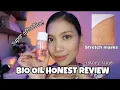 Bio Oil Honest Review Very Effective for Stretch Marks 2021 Belle Merto