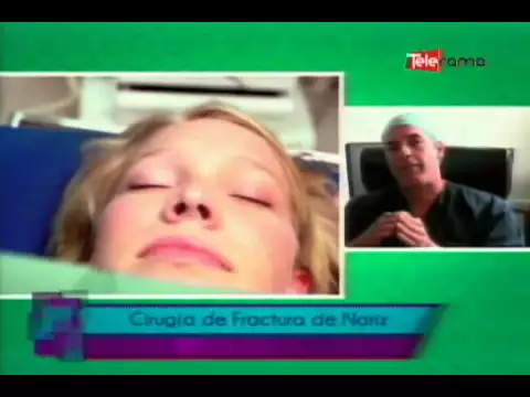 Cirugía de fractura de nariz