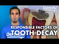 All about CAVITIES - Treatment prevention and causes of TOOTH DECAY Dentalk