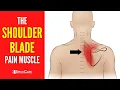 The Shoulder Blade Pain Muscle How to Release It for INSTANT RELIEF