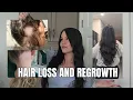Lagu HAIR LOSS AND REGROWTH! What I think happened and how I grew it back! 