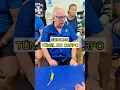 Download Lagu Síndrome do túnel do carpo #liberacaomiofascial #tuneldocarpo #fisioterapia