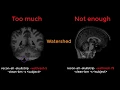FreeSurfer SkullStripping and Pial Surface Errors