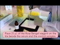 Rose bengal Test - diagnosis of brucellosis