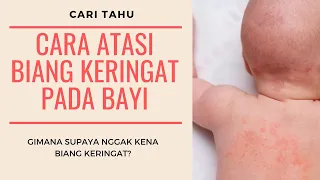 Download Cara Mengatasi Biang Keringat/Keringet Buntet Pada Bayi MP3