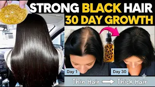 रूखे सूखे बेजान बालों में भी डाल देगा एक नई जान - 100% नए बाल उगाएँ | DIY Powerful Hair Growth Serum