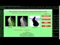 Apple Plant Disease Analysis Using Convolutional Neural Network Python Project With Source Code