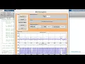 Encryption and Decryption of ECG signal matlab project source code