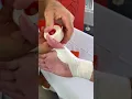 Quick functional and simple technique for thumb taping