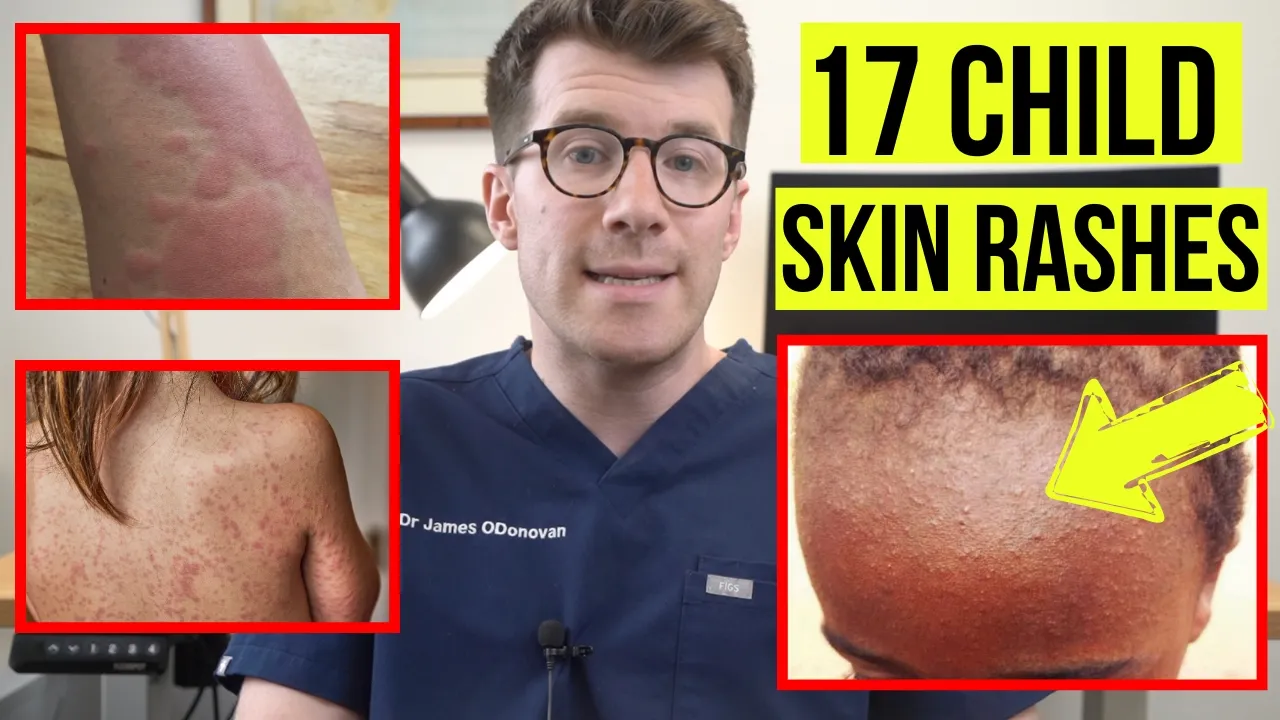 Identifying SKIN RASHES in BABIES and CHILDREN \| DOCTOR explains 17 COMMON SKIN CONDITIONS