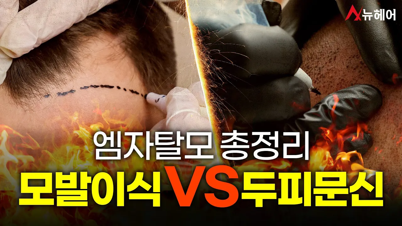 엠자탈모면 클릭! 모발이식VS두피문신 장단점 총정리, 당신의 선택은?ㅣ뉴헤어