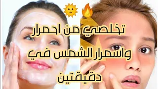 علاج حروق شمس البحر في دقيقتين وازي تتخلصي من احمرار واسمرار الشمس من اول إستعمال 