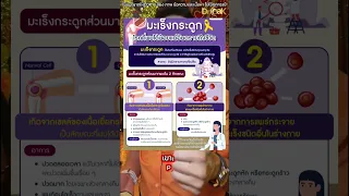 ปวดลึกๆ ในกระดูก ไม่ใช่ปวดกล้ามเนื้อ อาจเป็นสัญญาณเตือนของโรคอะไรได้บ้าง