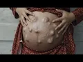 The alien belly 4