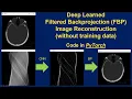 Code for Deep Learned Filtered Backprojection FBP Image Reconstruction PyTorch