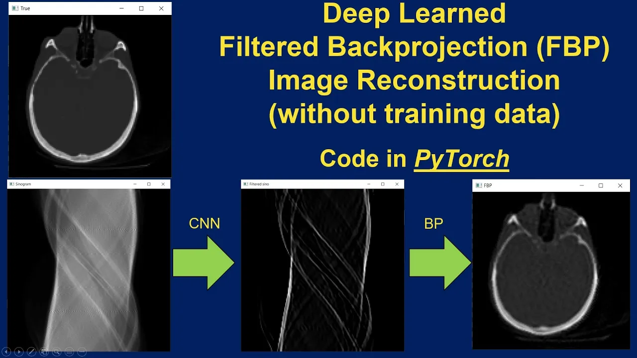 Code for Deep Learned Filtered Backprojection (FBP) Image Reconstruction (PyTorch)