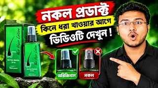 সব রেকর্ড ভাঙলো বিজ্ঞান! ৪১৪% বেশি চুল গজানোর এই প্রাকৃতিক উপায়টি আগে জানতেন?
