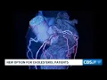 FDA approves new cholesterol-lowering pill for adults with high LDL levels