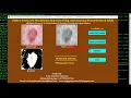 Skin Disease Detection Using CNN Convolutional Neural Network Python OpenCV Project Source Code