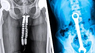 Las 20 Cosas Más Extrañas Descubiertas Por Los Rayos X