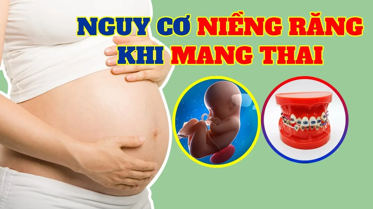 Outline Video Có Nên Niềng Răng Khi Mang Thai ? - Giải đáp thắc mắc của bà bầu