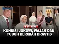 Download Lagu TERUNGKAP! Kondisi Jokowi, Wajah dan Tubuh Berubah Drastis, Ajudan Sebut tak Bisa Kena Panas
