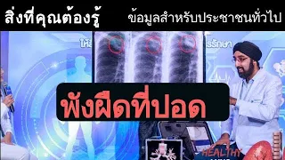 พังผืดปอดคืออะไร และเกิดจากสาเหตุใดบ้าง