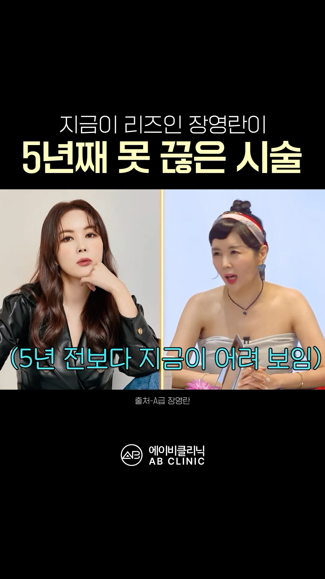 장영란이 5년 동안 받은 피부 시술