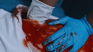 Shoved Her Hand Inside His Chest!