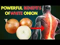 Top 10 Powerful Benefits of White Onion