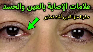 علامات تدل على أنك مصاب بالعين والحسد وأنك في خطر كبير؟ إياك أن تتجاهلها.. حذرنا منها النبي ﷺ