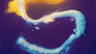 انا شعري شاب جالي اكتئاب دندنها