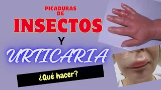 ¡PELIGRO! CUIDADO CON LAS PICADURAS DE INSECTOS