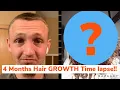 Download Lagu 4 months HAIR GROWTH Time-lapse *this is crazy*