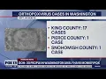 20 people in Washington likely have monkeypox according to the Department of Health FOX 13 Seattl